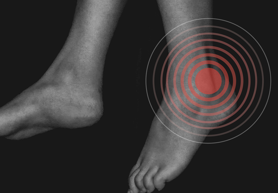 Dr Hoffman Ankle Instability012125